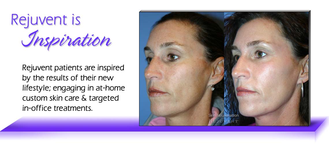 Rejuvent Inspiration Skin Rejuvenation – Rejuvent Medical Spa Scottsdale