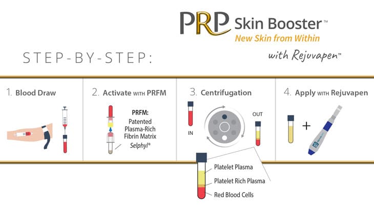 Prp Facial Treatment • Rejuvent Medical Spa Scottsdale