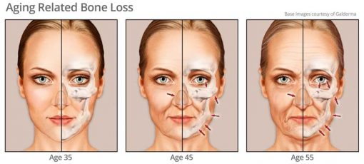 What Happens To Your Face And Skin As You Age Video • Rejuvent Medical